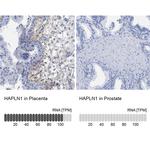 HAPLN1 Antibody in Immunohistochemistry (IHC)