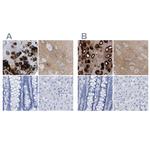 HAPLN1 Antibody in Immunohistochemistry (IHC)