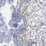 HAPLN1 Antibody in Immunohistochemistry (IHC)