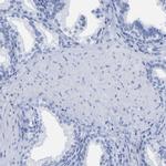 HAPLN1 Antibody in Immunohistochemistry (IHC)