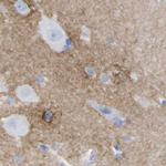 HAPLN1 Antibody in Immunohistochemistry (IHC)