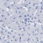 HAPLN1 Antibody in Immunohistochemistry (IHC)