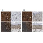 NUDCD3 Antibody in Immunohistochemistry (IHC)