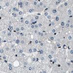 NUDCD3 Antibody in Immunohistochemistry (IHC)