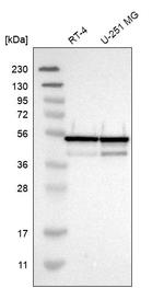 NUDCD3 Antibody in Western Blot (WB)