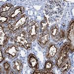 Aquaporin 1 Antibody in Immunohistochemistry (IHC)