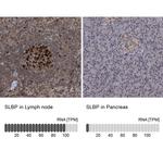 SLBP Antibody in Immunohistochemistry (IHC)