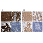 GDA Antibody in Immunohistochemistry (IHC)