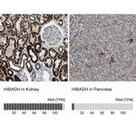 HIBADH Antibody in Immunohistochemistry (IHC)