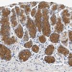 PPM1L Antibody in Immunohistochemistry (IHC)