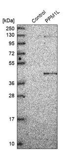 PPM1L Antibody in Western Blot (WB)