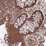 KIAA0391 Antibody in Immunohistochemistry (Paraffin) (IHC (P))