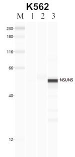 NSUN5 Antibody in RNA Immunoprecipitation (RIP)