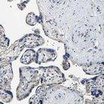 KIAA1958 Antibody in Immunohistochemistry (IHC)