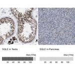 SQLE Antibody