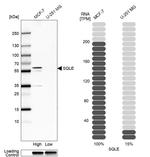 SQLE Antibody in Western Blot (WB)