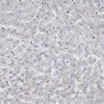 ZMYND8 Antibody in Immunohistochemistry (IHC)