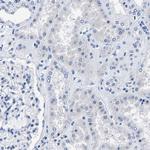 KIAA1045 Antibody in Immunohistochemistry (Paraffin) (IHC (P))