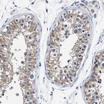 KIAA1045 Antibody in Immunohistochemistry (Paraffin) (IHC (P))