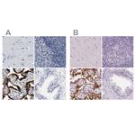 HSD17B1 Antibody in Immunohistochemistry (IHC)