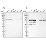 TCP-1 theta Antibody in Western Blot (WB)