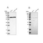 NPLOC4 Antibody in Western Blot (WB)