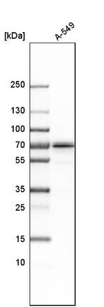 NPLOC4 Antibody in Western Blot (WB)