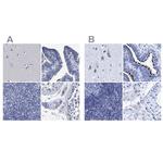 CROCC Antibody in Immunohistochemistry (IHC)