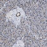 eIF4A3 Antibody in Immunohistochemistry (IHC)