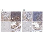 PFAS Antibody in Immunohistochemistry (IHC)