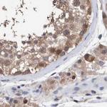 PFAS Antibody in Immunohistochemistry (IHC)