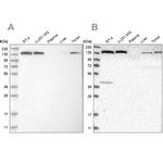 PFAS Antibody in Western Blot (WB)