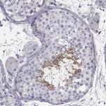 SPACA9 Antibody in Immunohistochemistry (IHC)