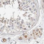 RNMTL1 Antibody in Immunohistochemistry (IHC)