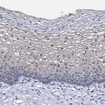 ZNF750 Antibody in Immunohistochemistry (IHC)