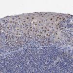 ZNF750 Antibody in Immunohistochemistry (IHC)