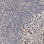 RNMTL1 Antibody in Immunohistochemistry (IHC)
