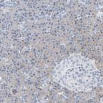 ADHFE1 Antibody in Immunohistochemistry (IHC)