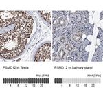 PSMD12 Antibody in Immunohistochemistry (IHC)