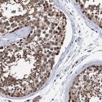 PSMD12 Antibody in Immunohistochemistry (IHC)