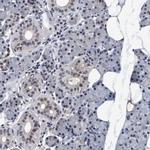 PSMD12 Antibody in Immunohistochemistry (IHC)