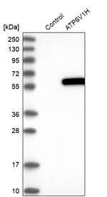 V-ATPase H Antibody in Western Blot (WB)