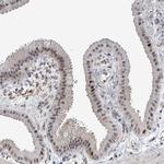 MSL1 Antibody in Immunohistochemistry (IHC)