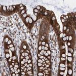 LRBA Antibody in Immunohistochemistry (IHC)