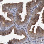 LRBA Antibody in Immunohistochemistry (IHC)