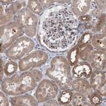 LRBA Antibody in Immunohistochemistry (IHC)