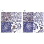 STAR Antibody in Immunohistochemistry (IHC)