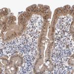 NAPRT1 Antibody in Immunohistochemistry (IHC)