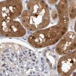 NAPRT1 Antibody in Immunohistochemistry (IHC)