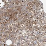 CLCN2 Antibody in Immunohistochemistry (Paraffin) (IHC (P))